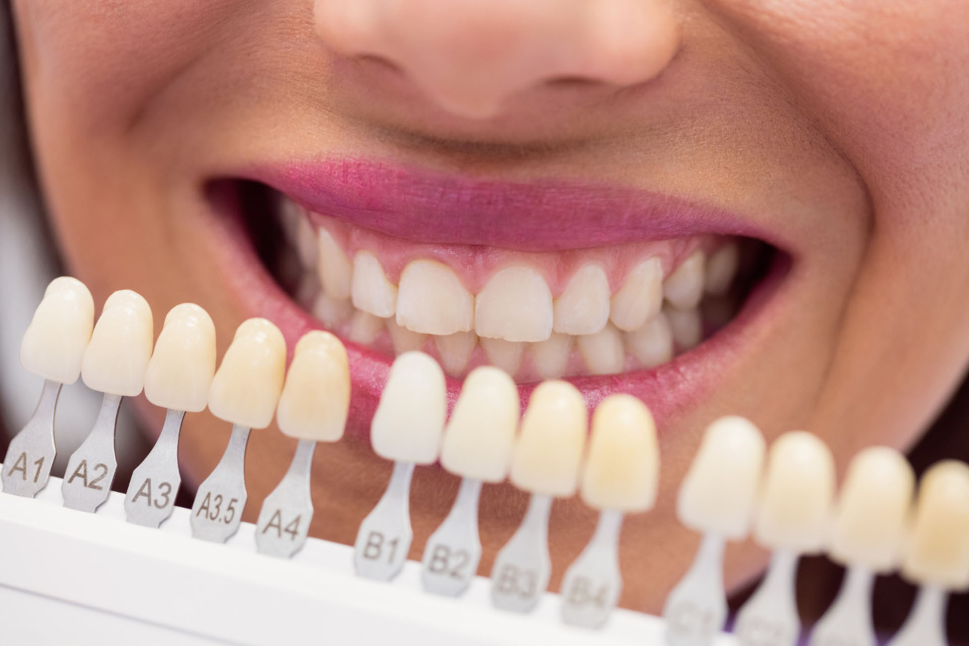 Dental crowns treatment banner at Accord Dental Practice